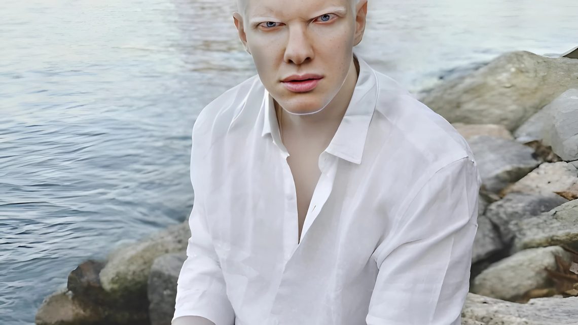 Muž se vzácným vzhledem vychovává dvě děti, které se narodily v manželství s modelkou.