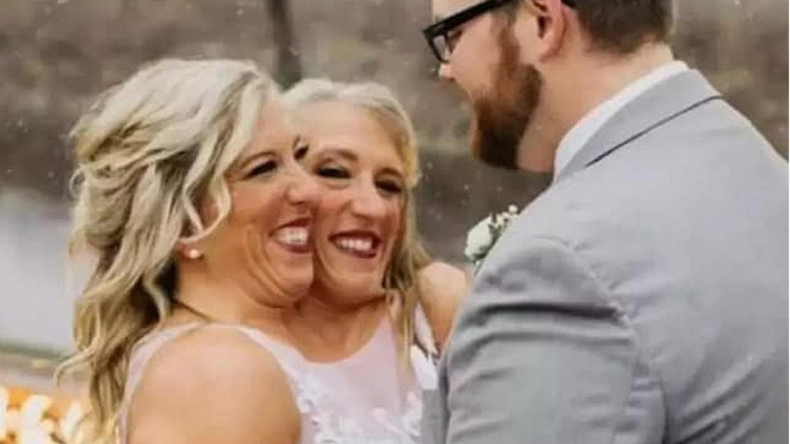 Těmto siamským dvojčatům se podařilo vzít si jednoho muže. Podařilo se jim vybudovat šťastnou rodinu? Těmto siamským dvojčatům se podařilo vzít si jednoho muže. Podařilo se jim vybudovat šťastnou rodinu?