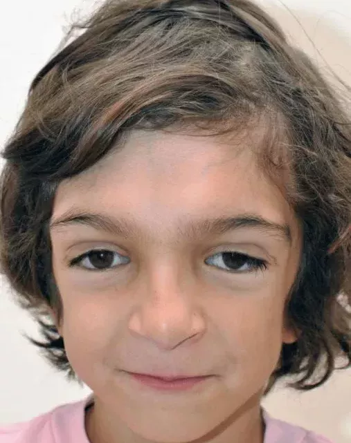 Lékaři se podařilo opravit obličej tohoto chlapce. Podívejte se, jak vypadá dnes.