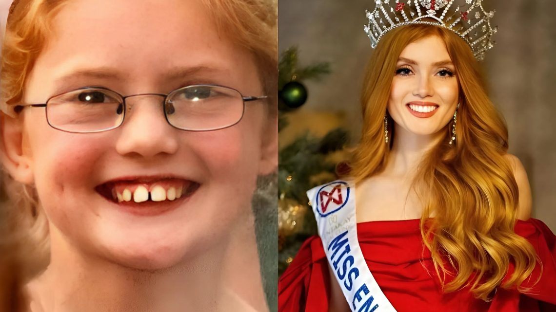 Miss Anglie. Věřili byste, že ji dříve ve škole škádlili kvůli jejím zrzavým vlasům?