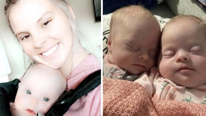 Mère de rares jumelles atteintes de trisomie 21 : elle prouve leur beauté et leur valeur pour faire taire les critiques