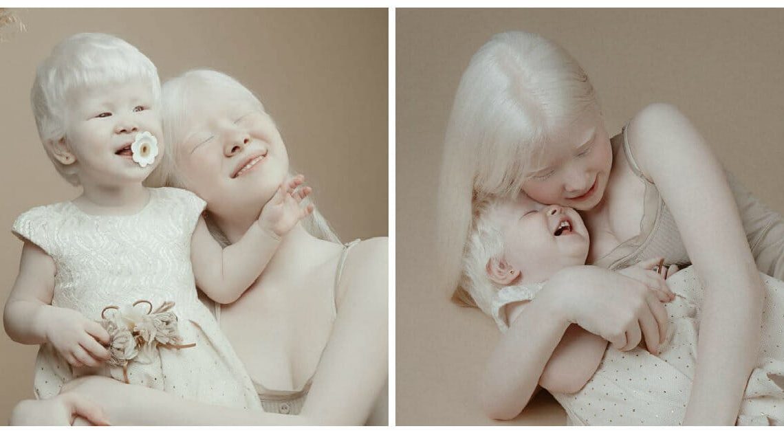 Surorile albino, născute la 12 ani distanță, devin senzații în lumea modei