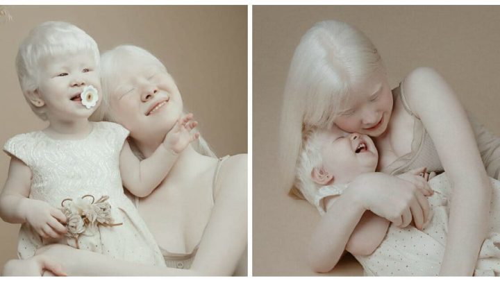 Surorile albino, născute la 12 ani distanță, devin senzații în lumea modei