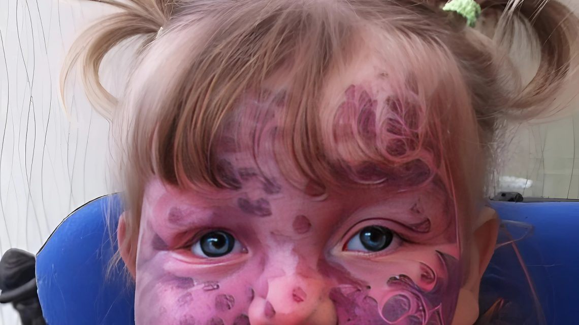 I složitou nemoc lze porazit, pokud se nevzdáte.