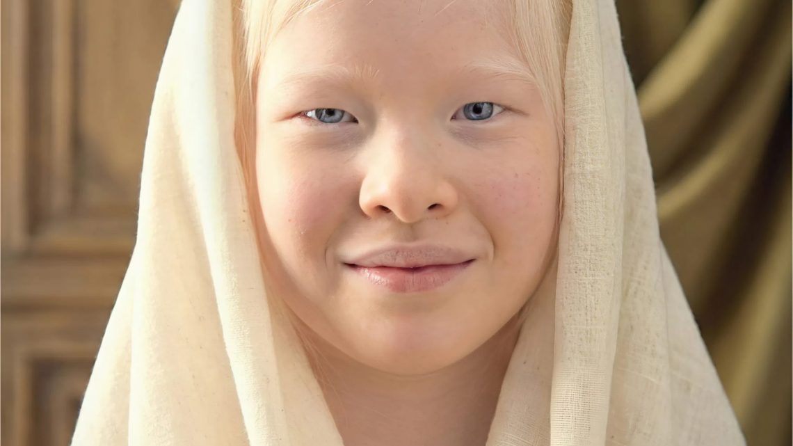 Od opuštěného dítěte k modelce Vogue: Jak Xueli Abbing přepisuje definici krásy a zvyšuje povědomí o albinismu