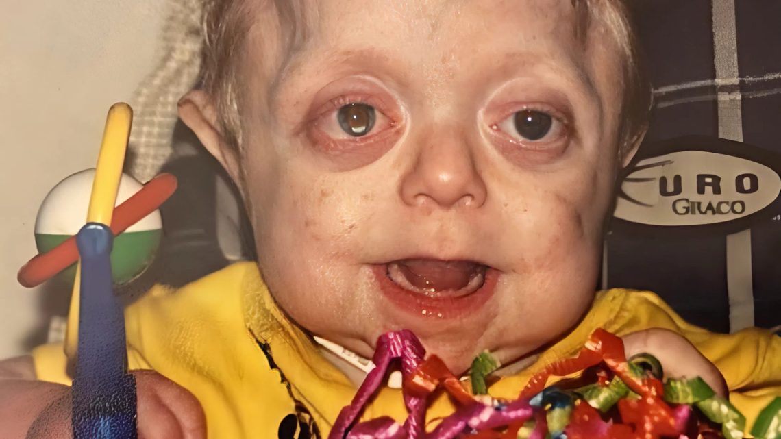 Teenager, kterému nedávali naději na přežití déle než 18 měsíců, dokončil střední školu