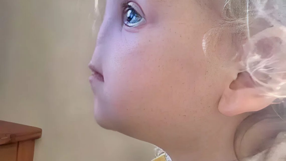 Tessa Evans se narodila bez nosu. Takto vypadá ve svých 12 letech.