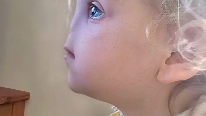 Tessa Evans se narodila bez nosu. Takto vypadá ve svých 12 letech.