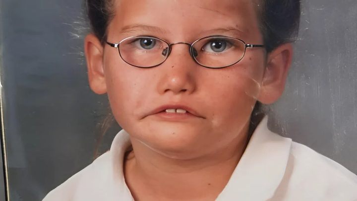 „Princezna bez úsměvu“: Jak dívka s tímto syndromem žije, aniž by se usmívala – Jak vypadá teď?