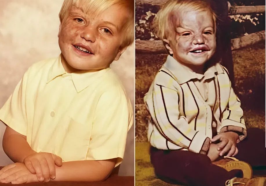 Přežít nepředstavitelné: Keith Edmonds bojuje o život