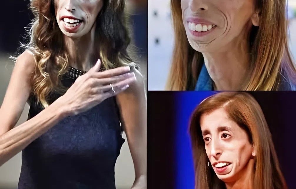 „Žena s krutým osudem”: jak dnes vypadá dívka, kterou nazývali „nejošklivější na světě”?