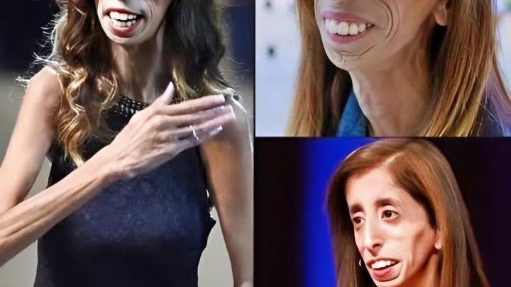 „Žena s krutým osudem”: jak dnes vypadá dívka, kterou nazývali „nejošklivější na světě”?